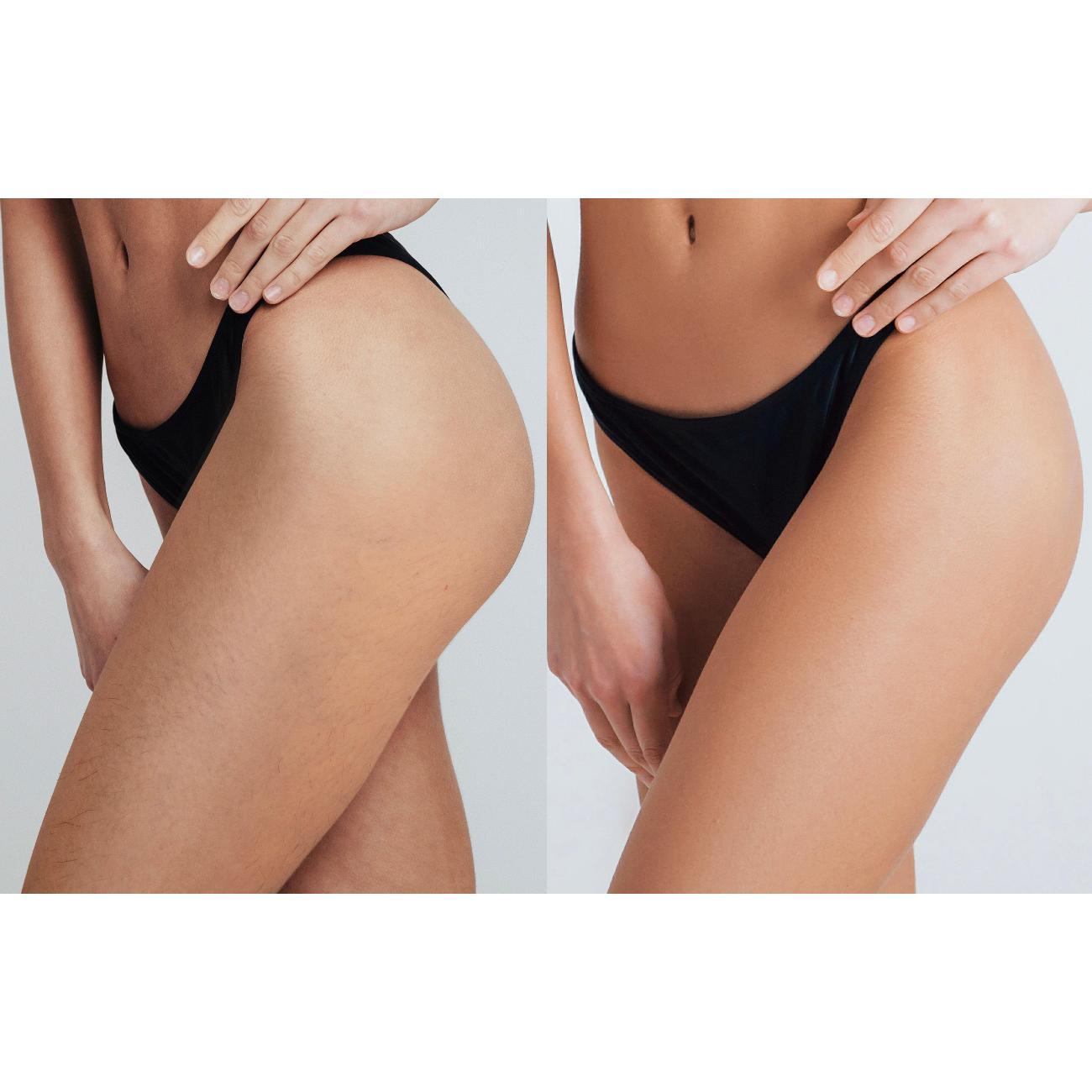 Фотоэпилятор Foreo PEACH 2 Pro Max