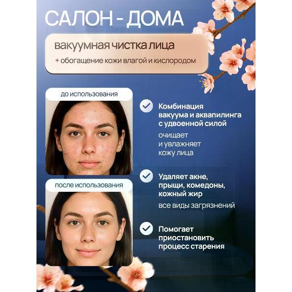 Инструмент для чистки лица Laichy Аквапилинг