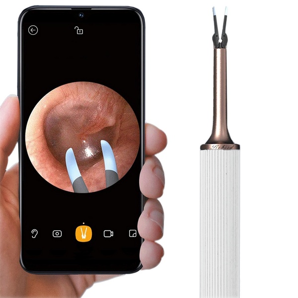 Умная ушная палочка Xiaomi Bebird Smart Visual Ear Stick Note 3 белый