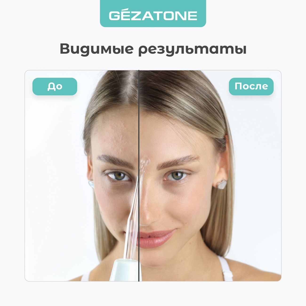 Купить Дарсонваль для лица, тела и волос Gezatone Biolift4 118 в каталоге  интернет магазина М.Видео по выгодной цене с доставкой, отзывы, фотографии  - Москва