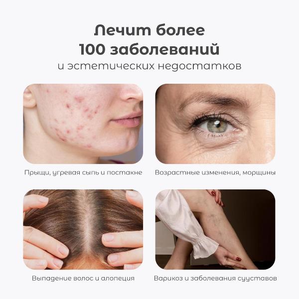 Изображение товара Дарсонваль Gezatone BP-7000